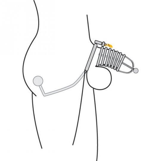 cbt uretal cage 